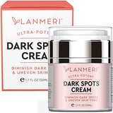 Lanmeri Dark Spot Corrector: Dark Spot Remover for Face and Body - Dark Spot Corrector for Face – Suitable for All Skin Types - Dark Spot Remover for Women and Men (1.7 FL OZ)