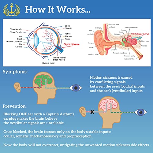 No More Motion Sickness Earplugs by Captain Arthur for Adults & Kids – Anti Nausea Seasickness Relief – Sea Sickness Travel Sickness & Car Sickness Prevention Cruise Ship Essentials