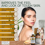 Advanced Clinicals Turmeric Oil Facial Skin Care Serum For Face. Antioxidant Moisturizer Skincare Formula W/Rose Extract & Jojoba Oil For Dry Skin, Redness, & Skin Blemishes, 1.8 Fl Oz