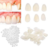 Healthyare Tooth Repair Kit-Temporary Fixing Missing and Broken Tooth Fake Teeth, 60 Piece Assortment