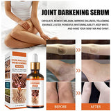 Dark Knuckle Whitening Serum, 1.7 Fl Oz Joint Darkening Serum, Lighten And Repair Melanin, Skin Care Removal Body Bleaching For Knuckle Elbows