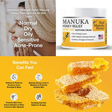 Manuka Honey Cream (8oz) Body Lotion Skincare Relief - Eczema Honey Cream for Psoriasis, Itchy, Dry Skin - Face Moisturizer For Kids, Adults, Baby Eczema Cream with Manuka Honey New Zealand