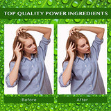 Hair Growth Serum, Hair Growth Oil With Biotin & Castor Oil, Hair Growth For Women, Hair Loss Treatments, Rosemary Oil For Hair Growth, Hair Growth Products For Thicker Longer Fuller Healthier Hair