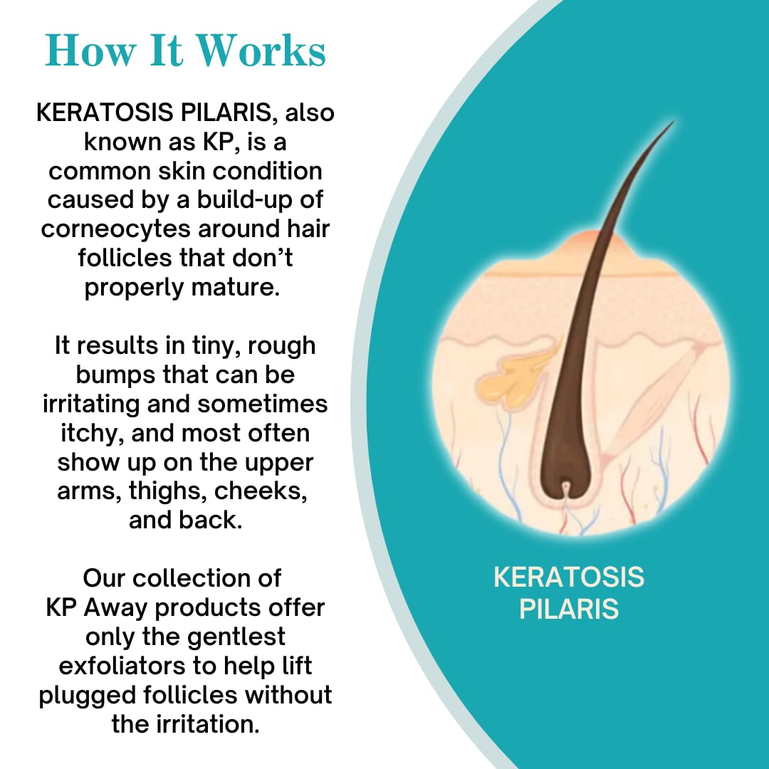 KPAWAY Keratosis Pilaris Treatment Lipid Repair Emollient, Baby Friend