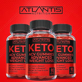 Keto ACV Gummies for Weight Loss - Supports Digestion, Advanced Weight Loss, Detox & Cleansing - Apple Cider Vinegar Keto ACV Gummies Formulated with 1000MG ACV Per Serving - 90 Count (Pack of 1)
