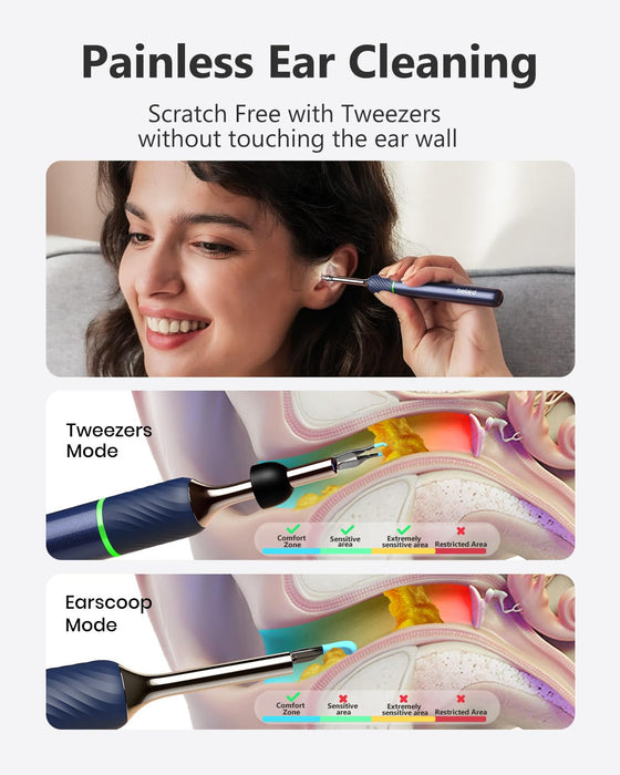 [Cutting-Edge] BEBIRD Note5 Ear Wax Removal Tool: Ear Cleaner with Camera 10 Megapixel Otoscope, Omni-Direction Tweezer, Real-Time Remote Video, Magnetic Cap, Multi Earwax Cleaning Replacement Tips