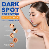 Dark Spot Corrector For Face and Body, Dark Spot Correcting Cream, Sun Spot Remover For Face, Neck, Hands, Knees, Legs, Intimate Areas, Dark Spot Remover