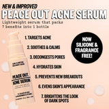 Peace Out Skincare Acne Serum. Daily Multi-Benefit Face Serum with 2% Salicylic Acid to Target Pimples, Zits, Blemishes and Breakouts, For Clearer-Looking Skin (1 fl oz)