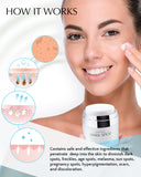 EnaSkin Dark Spot Remover for Face and Body: Natural Ingredient - Freckle/Melasma/Sun Spot/Age Spot Remover - Dark Spot Corrector Cream for Women and Men