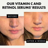 Eclat Skincare Face Serum Set - Vitamin C Serum for Radiance, Retinol Serum for Wrinkles