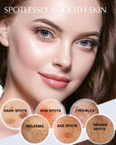 EnaSkin Dark Spot Remover for Face and Body: Natural Ingredient - Freckle/Melasma/Sun Spot/Age Spot Remover - Dark Spot Corrector Cream for Women and Men