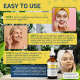 Advanced Clinicals - Retinol Serum For Face, Firming Collagen Serum, Vitamin C Serum Skincare Set, 1.75 Fl Oz, 3pc Set