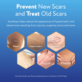 ScarAway Complete Scar Treatment Kit, Clinically Supported Scar Treatment, (2) Tan Medical-Grade Silicone Scar Sheets (1.5" x 3") and Silicone Scar Gel (0.35 Oz), Water-Resistant & Self-Adhesive
