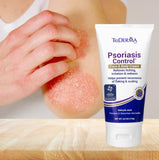 TriDerma Psoriasis Control Face & Body Cream - Maximum Strength 3% Salicylic Acid, AP4 Aloe Vera Gel, Urea Cream - Extra Moisturizing Treatment, No Cortisone or Coal Tar - FSA Eligible - 6 Oz