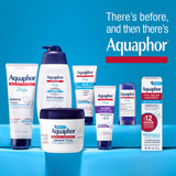 Aquaphor Children's Healing Ointment, Advanced Therapy Skin Protectant, Dry Skin Body Moisturizer, Multi-Purpose Healing Ointment for Kids, For Dry, Cracked Skin & Minor Cuts & Burns, 14 Oz Jar